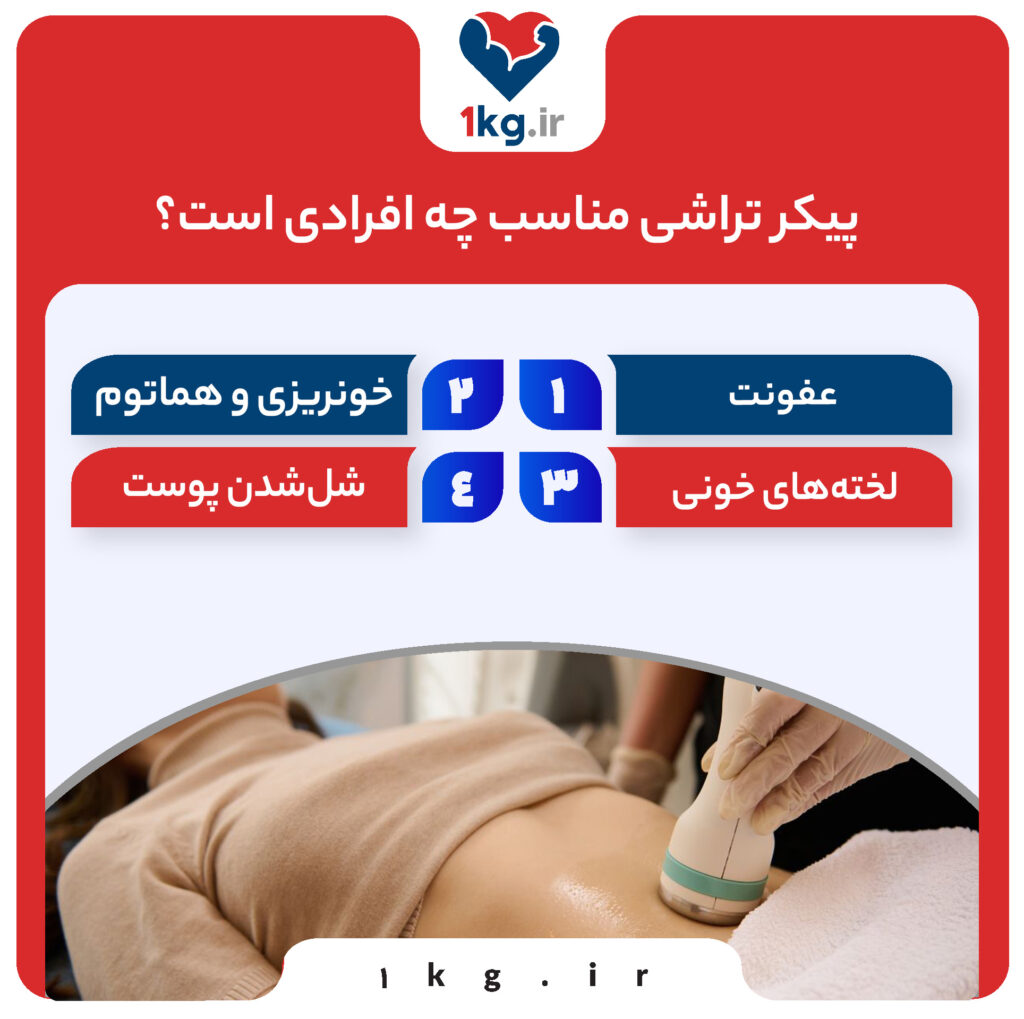 پیکرتراشی، یک روزه لاغر شوید!