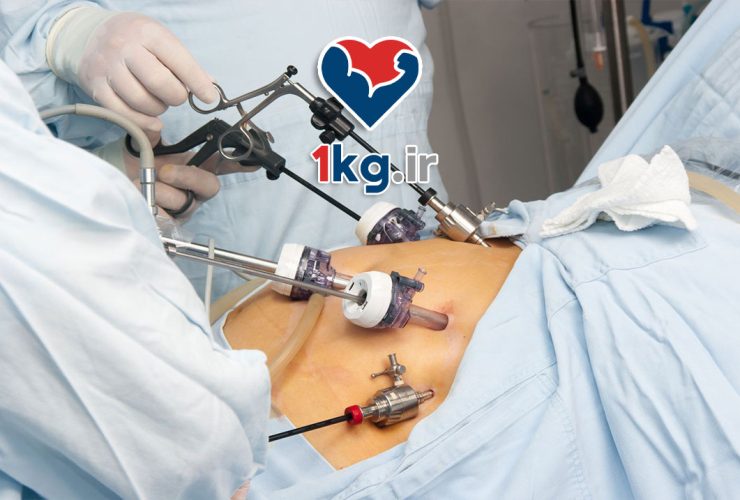 عمل بای پس معده؛ راهکاری موثر برای درمان چاقی مفرط