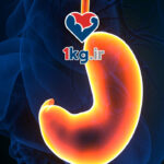 راهکارهای کاهش اسید معده: روش‌های طبیعی و پزشکی برای بهبود مشکلات گوارشی