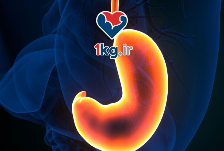 راهکارهای کاهش اسید معده: روش‌های طبیعی و پزشکی برای بهبود مشکلات گوارشی