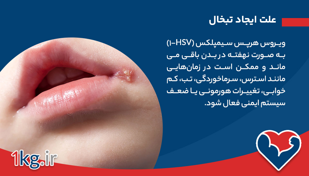 علت ایجاد تبخال