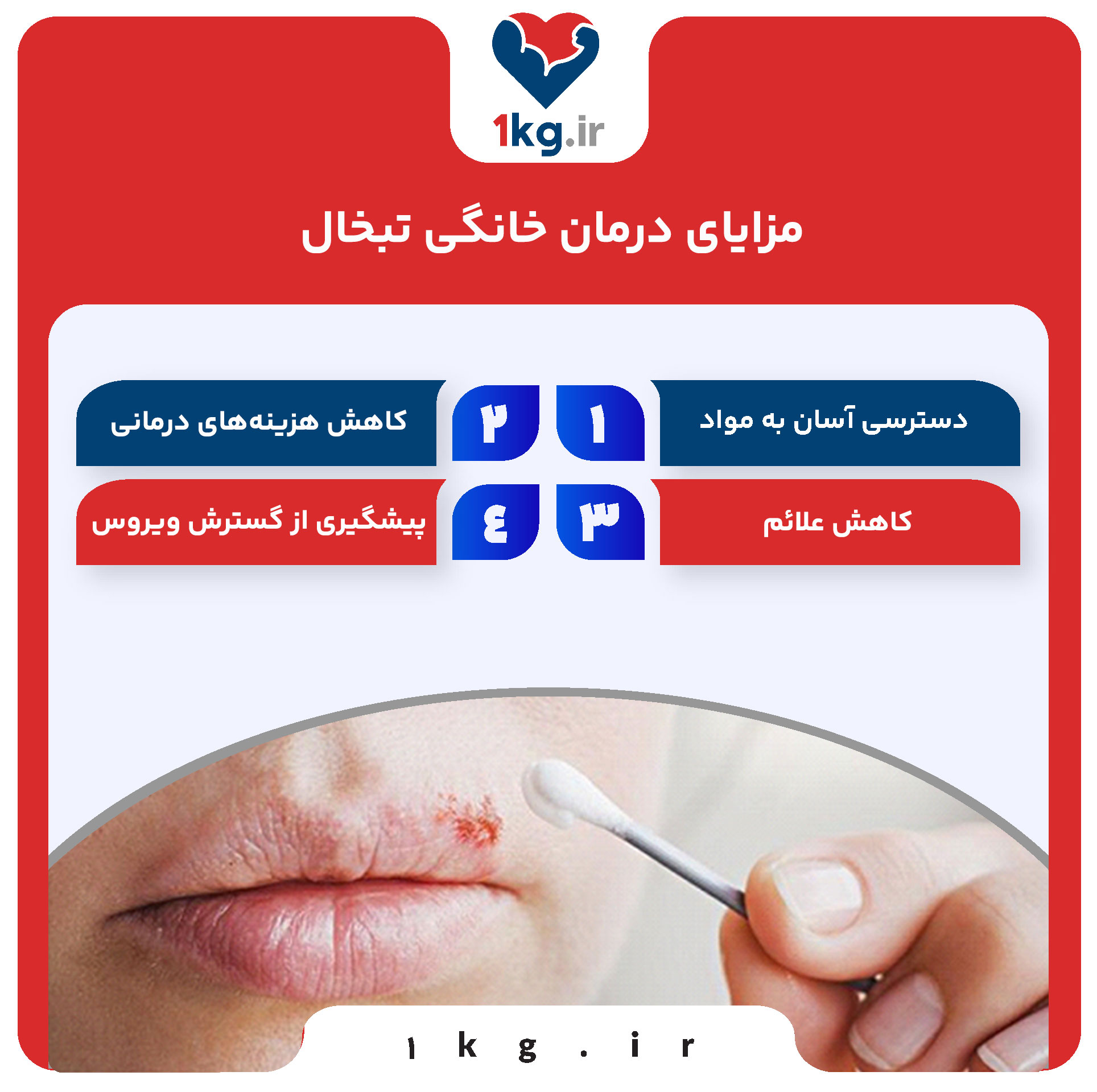 مزایای درمان خانگی تبخال