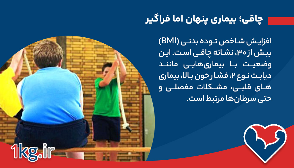چاقی؛ بیماری پنهان اما فراگیر
