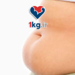   چاقی شکمی ناشی از کورتیزول