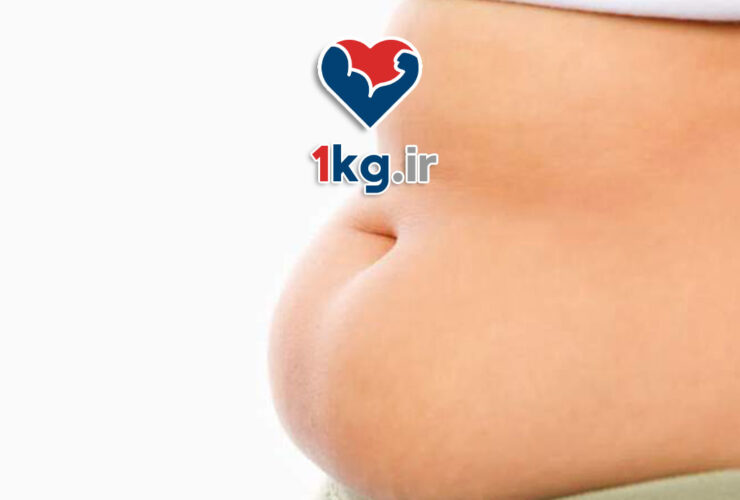   چاقی شکمی ناشی از کورتیزول