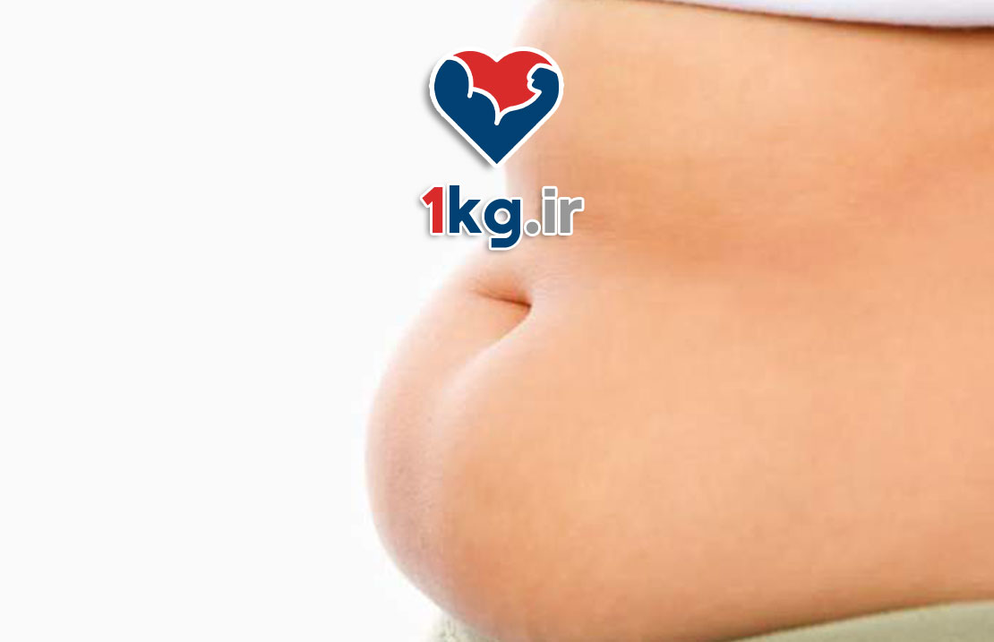 چاقی شکمی ناشی از کورتیزول 25 چاقی شکمی ناشی از کورتیزول