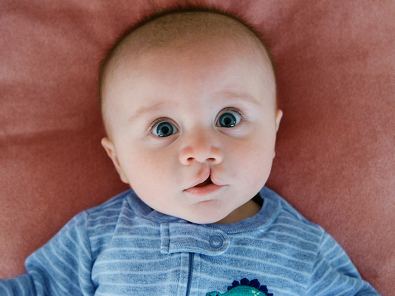 راهنمای جامع انتخاب دکتر جراحی شکاف لب و کام 25 راهنمای جامع انتخاب دکتر جراحی شکاف لب و کام