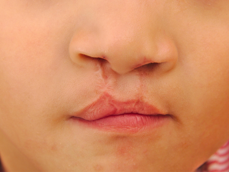 راهنمای جامع انتخاب دکتر جراحی شکاف لب و کام 26 جراح شکاف لب و کام در تهران