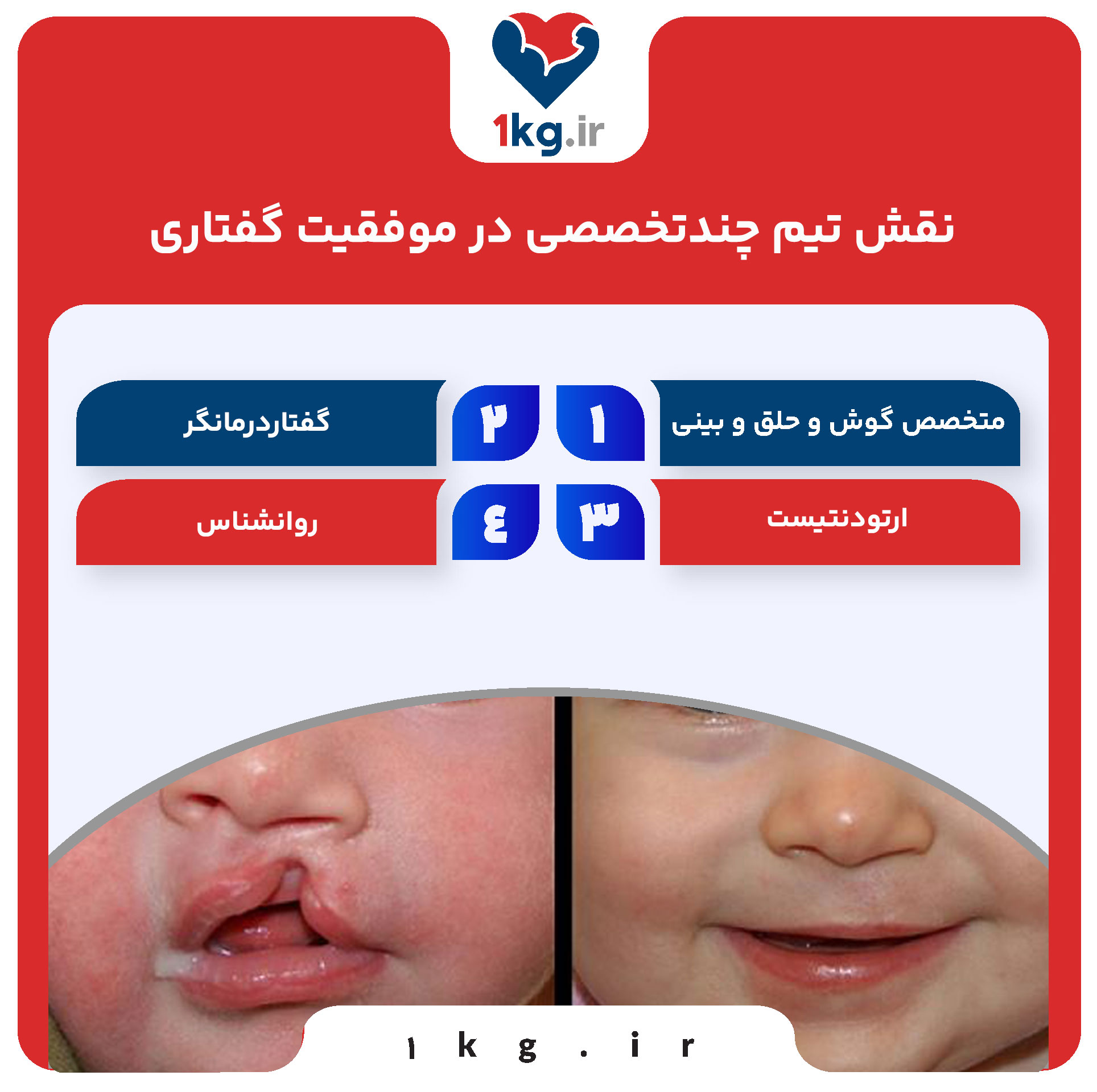 نقش تیم چندتخصصی در موفقیت گفتاری