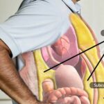 نشانه‌های چاقی و شکم هورمونی: چرا با ورزش و رژیم هم لاغر نمی‌شوم؟