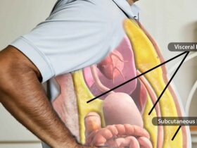 نشانههای چاقی و شکم هورمونی: چرا با ورزش و رژیم هم لاغر نمیشوم؟ 39 نشانههای چاقی و شکم هورمونی: چرا با ورزش و رژیم هم لاغر نمیشوم؟