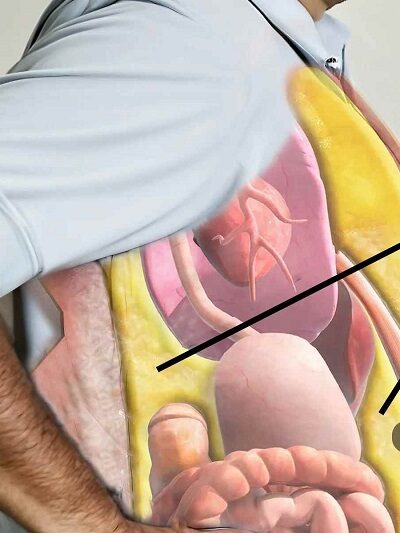 نشانههای چاقی و شکم هورمونی: چرا با ورزش و رژیم هم لاغر نمیشوم؟ 26 نشانههای چاقی و شکم هورمونی: چرا با ورزش و رژیم هم لاغر نمیشوم؟